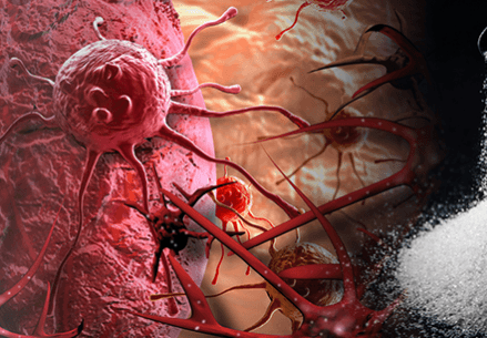 Xərçəng xəstəliyi və şəkərli qidalar: əlaqə varmı?