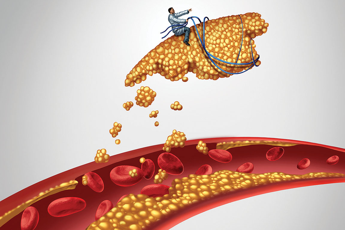 Dünyanı idarə edən xolesterin qorxusu