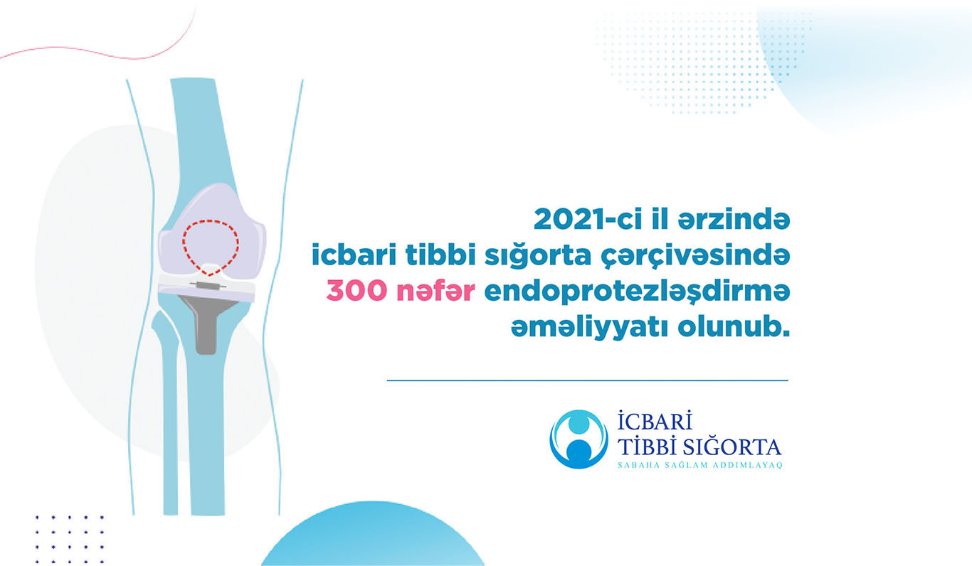 İcbari tibbi sığorta çərçivəsində endoprotezləşdirmə əməliyyatı