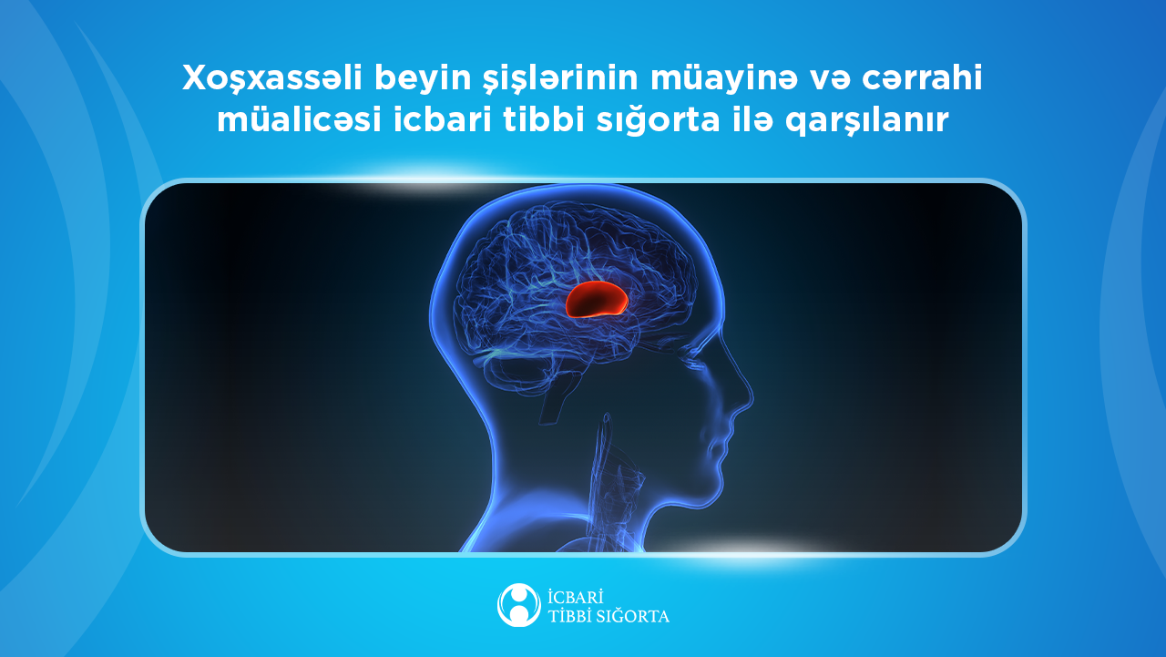 Xoşxassəli beyin şişlərinin müayinə və cərrahi müalicəsi icbari tibbi sığorta ilə qarşılanır
