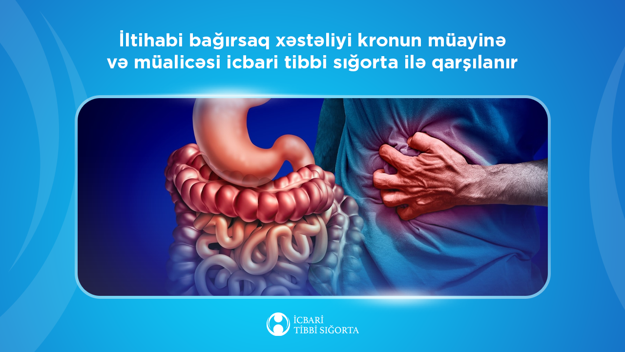 Bağırsaq xərçəngi riskini artıran kron xəstəliyinin müalicəsi  icbari tibbi sığorta ilə qarşılanır