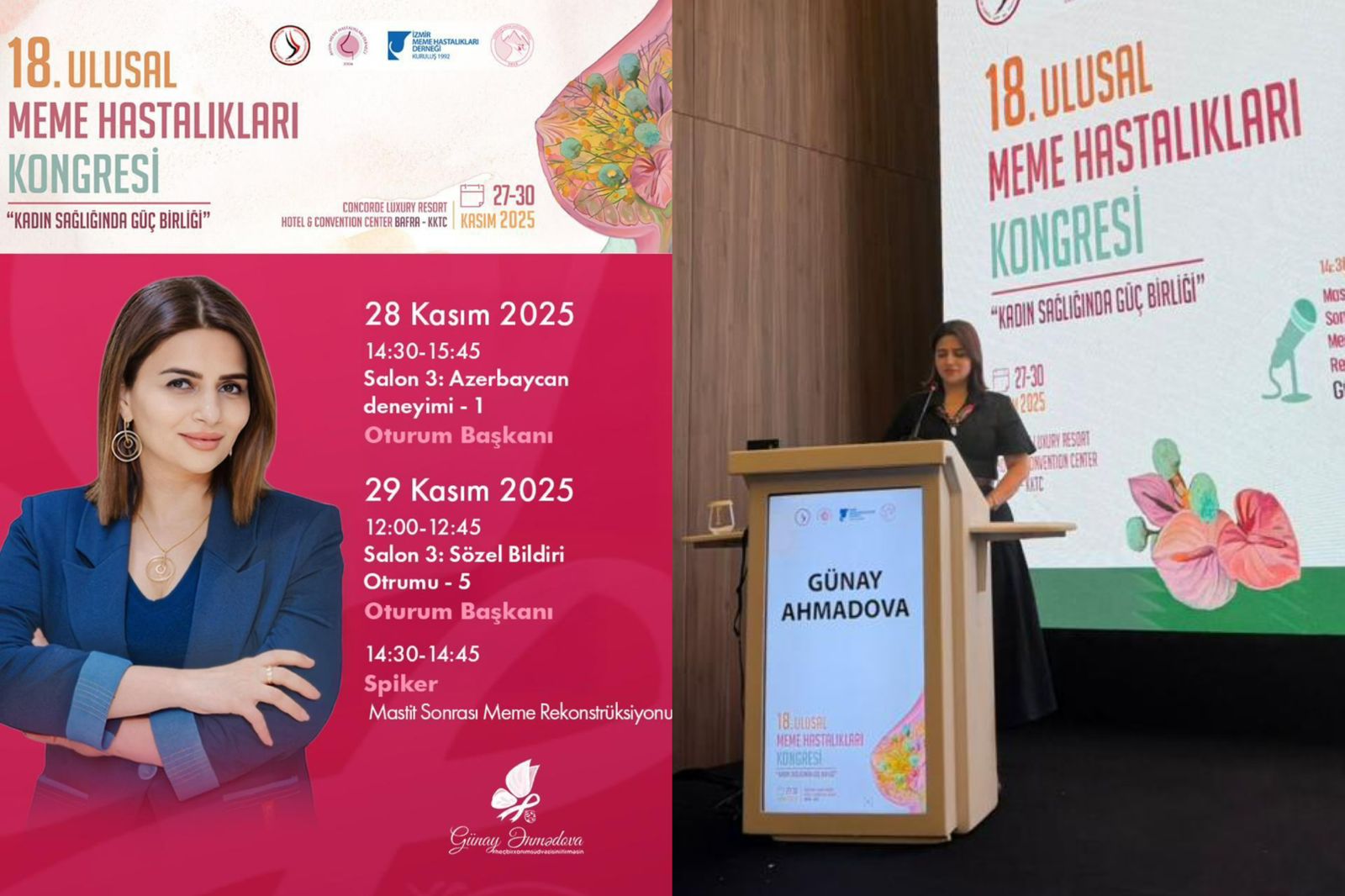 Referans Hayat Hospitalın həkimi beynəlxalq konfransda iştirak etdi – FOTO