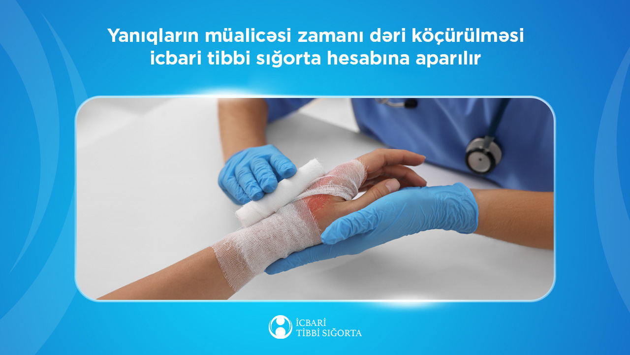 Yanıqların müalicəsi zamanı dəri köçürülməsi icbari tibbi sığorta hesabına aparılır